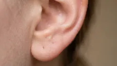 Miksi korvissa on niin paljon korvavahaa: totuus, josta ei kerrota